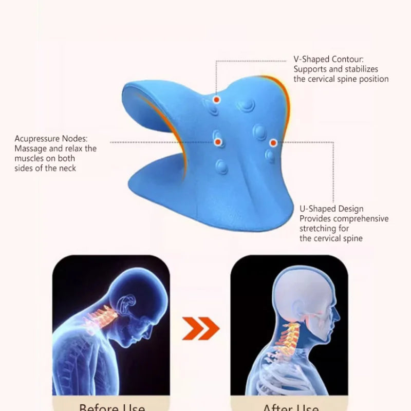 C-Shaped Neck Traction Pillow – Cervical Alignment Support Neck Traction Pillow Nixie