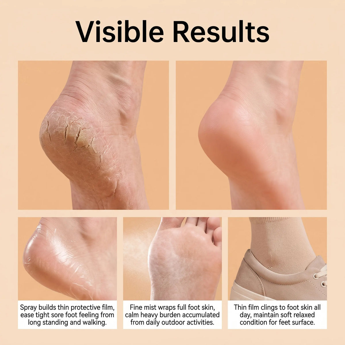 Bee Venom Foot Barrier Spray – 24H Anti-Friction Mist | 20ml Foot Care Spray Nixie