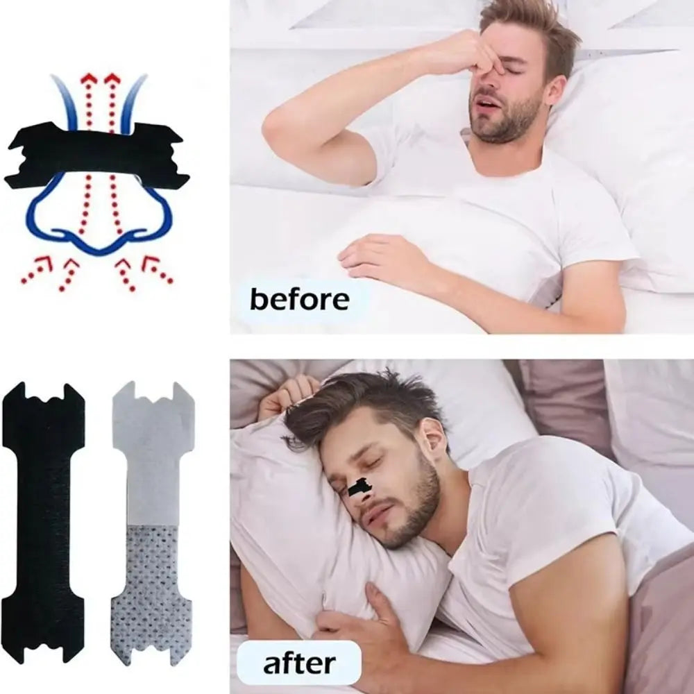 Hypoallergenic Nasal Strips for Better Sleep | 10 or 30 Pcs