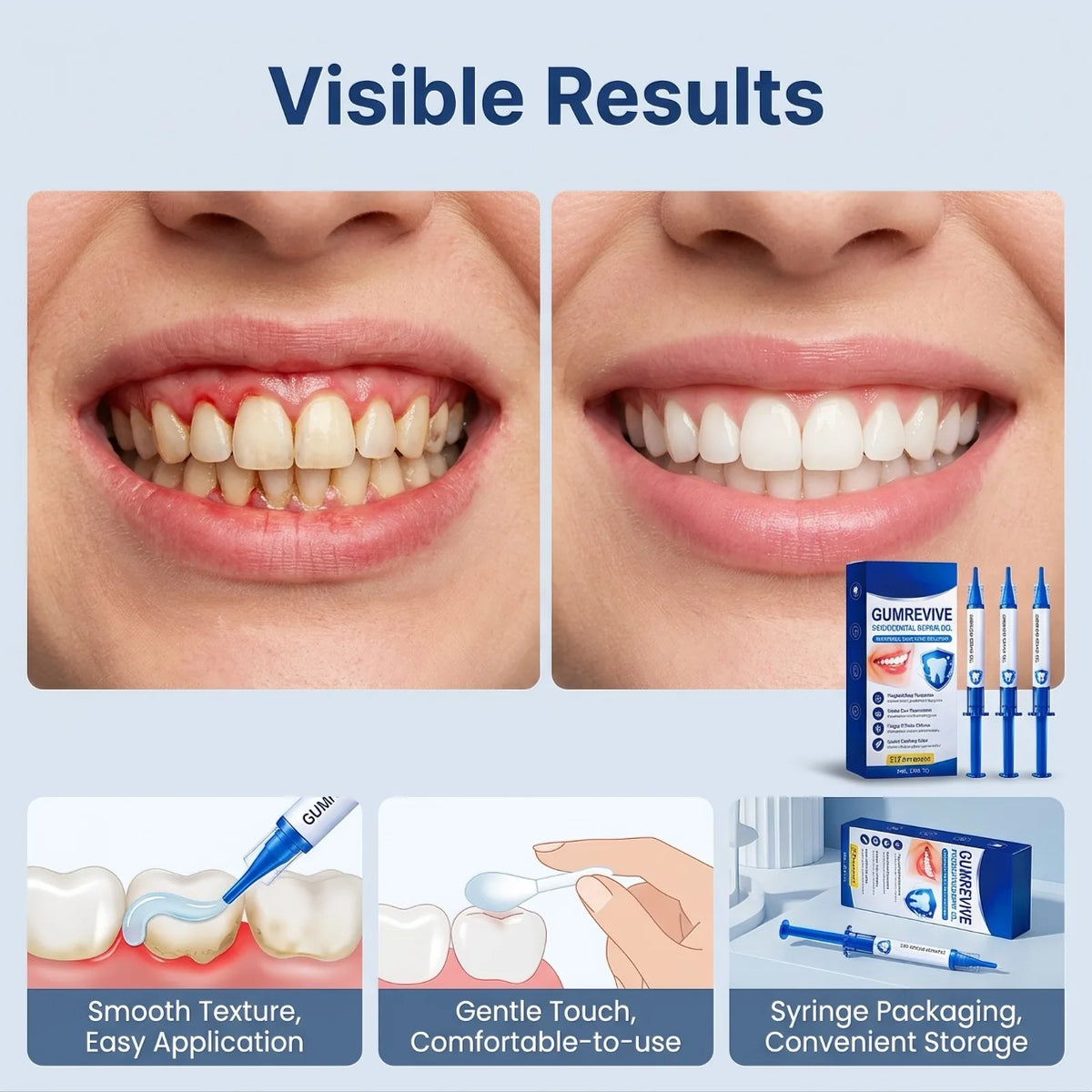 Gum Repair Gel – Plaque Removal, Whitening & Gum Care Oral Care Gel Nixie