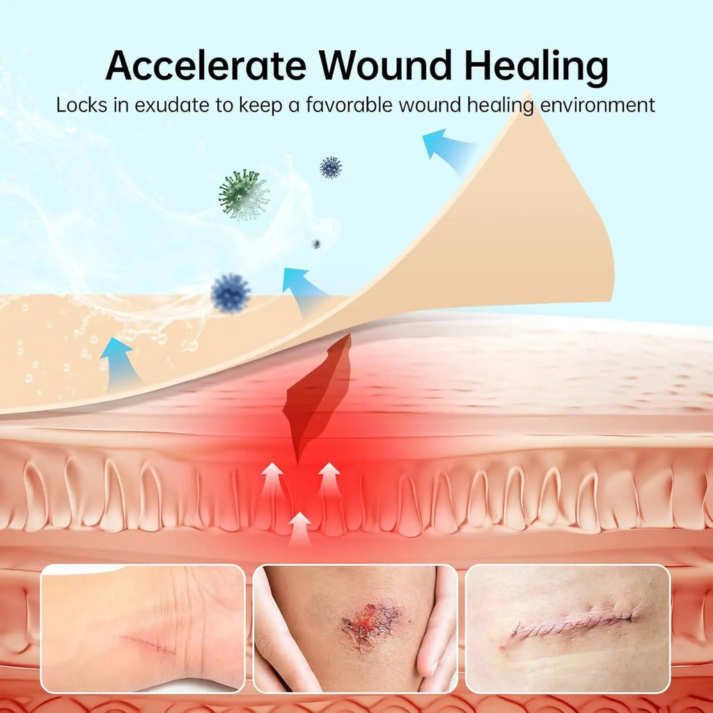 Hydrocolloid Roll Bandage – Waterproof Self-Adhesive Wound Care Hydrocolloid Bandage Nixie