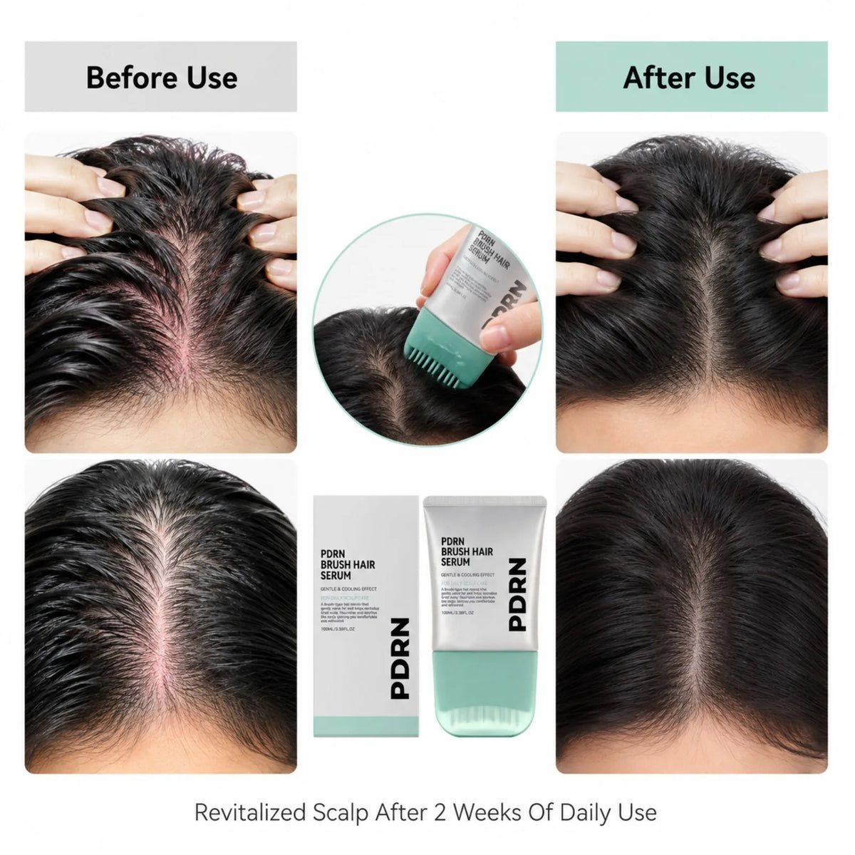 PDRN Hair Serum Cooling Brush – Scalp Nourishing Treatment Scalp Hair Serum Nixie