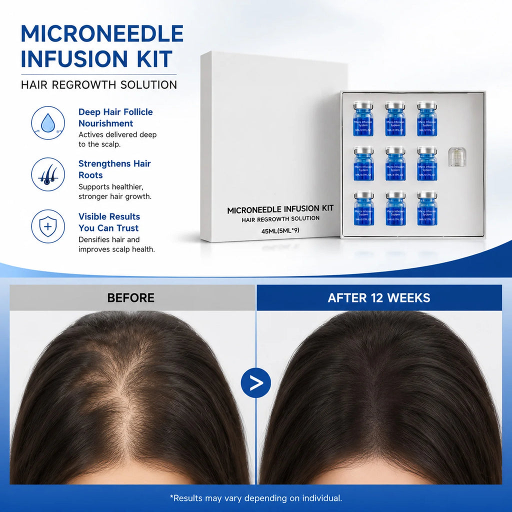 Microneedle Scalp Serum Kit – Nourishing Hair Care Set 45ml Scalp Serum Kit Nixie