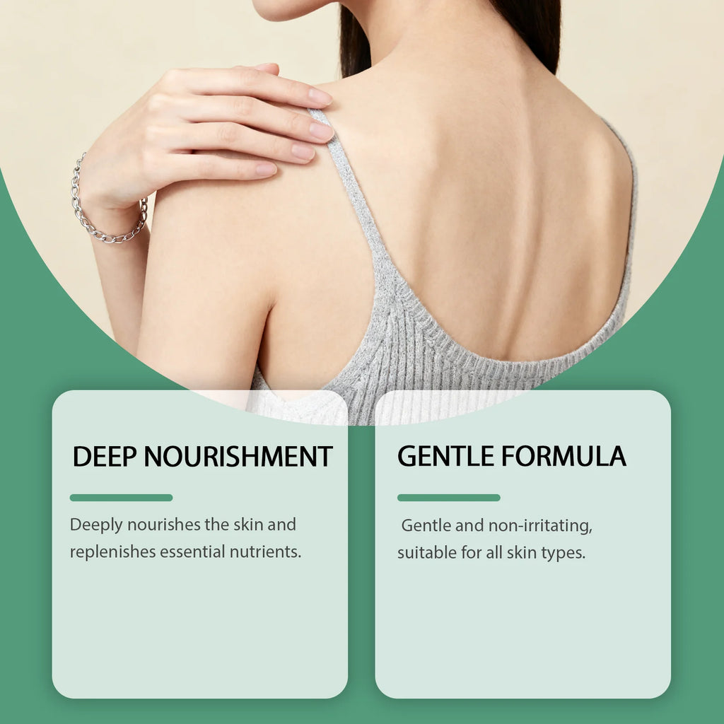 Ximonth Anti-Friction Skin Cream – Thighs & Underarms Anti-Friction Body Cream Nixie