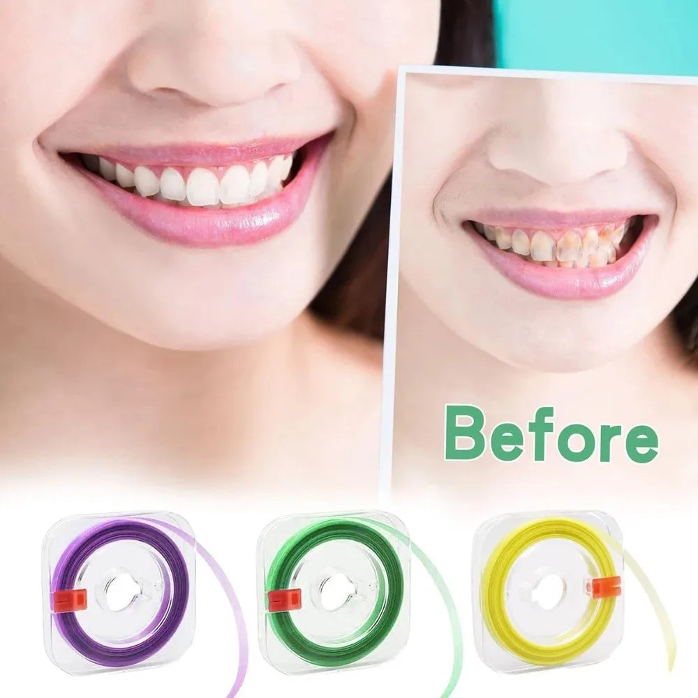 Dental Polishing Strips – Interdental Sanding & Finishing Dental Polishing Strips Nixie